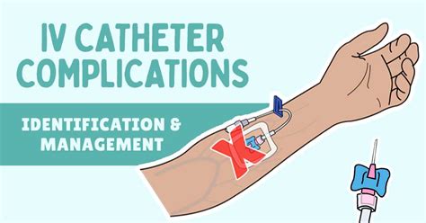 doxycycline infiltration|leaking from catheter to vessel.